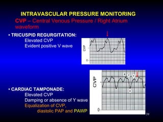 Hemodynamic Pressure Monitoring | PPT