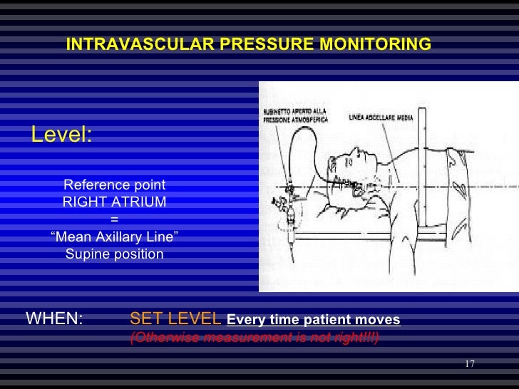 position blood 3 pressure test Monitoring Pressure Hemodynamic position blood 3 pressure test Monitoring Pressure Hemodynamic