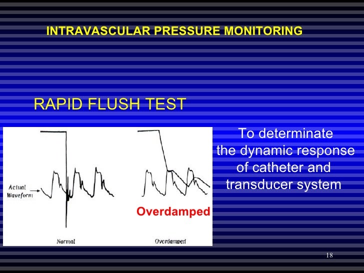 Hemodynamic Pressure Monitoring