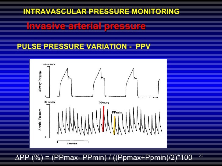 hemodynamic-pressure-monitoring