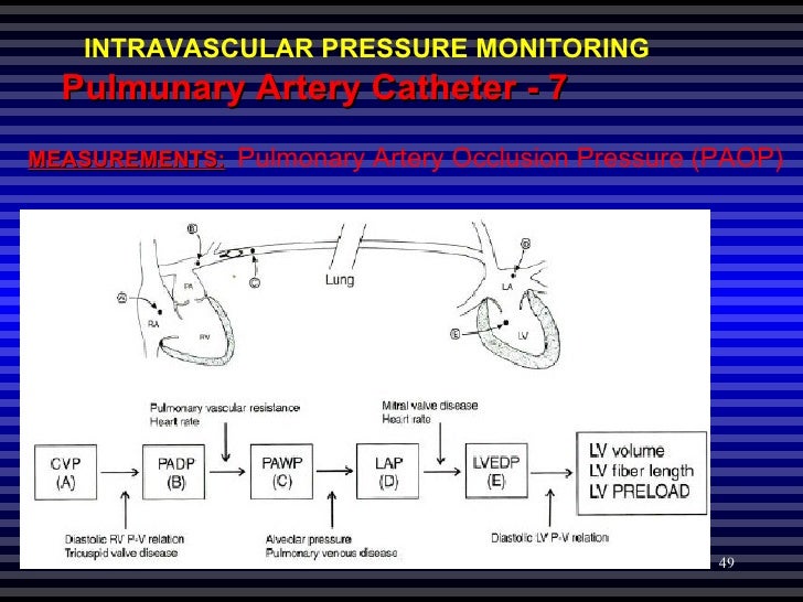 Hemodynamic Pressure Monitoring hemodynamic-pressure-monitoring