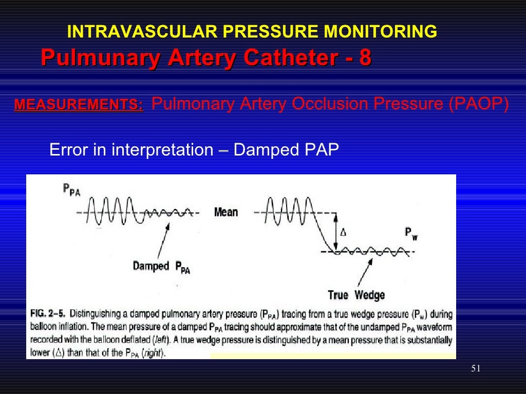 Hemodynamic Pressure Monitoring