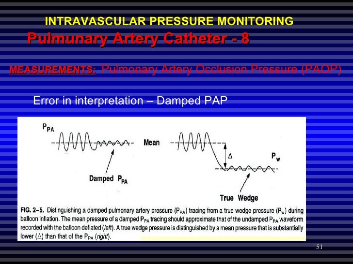 Hemodynamic Pressure Monitoring hemodynamic-pressure-monitoring