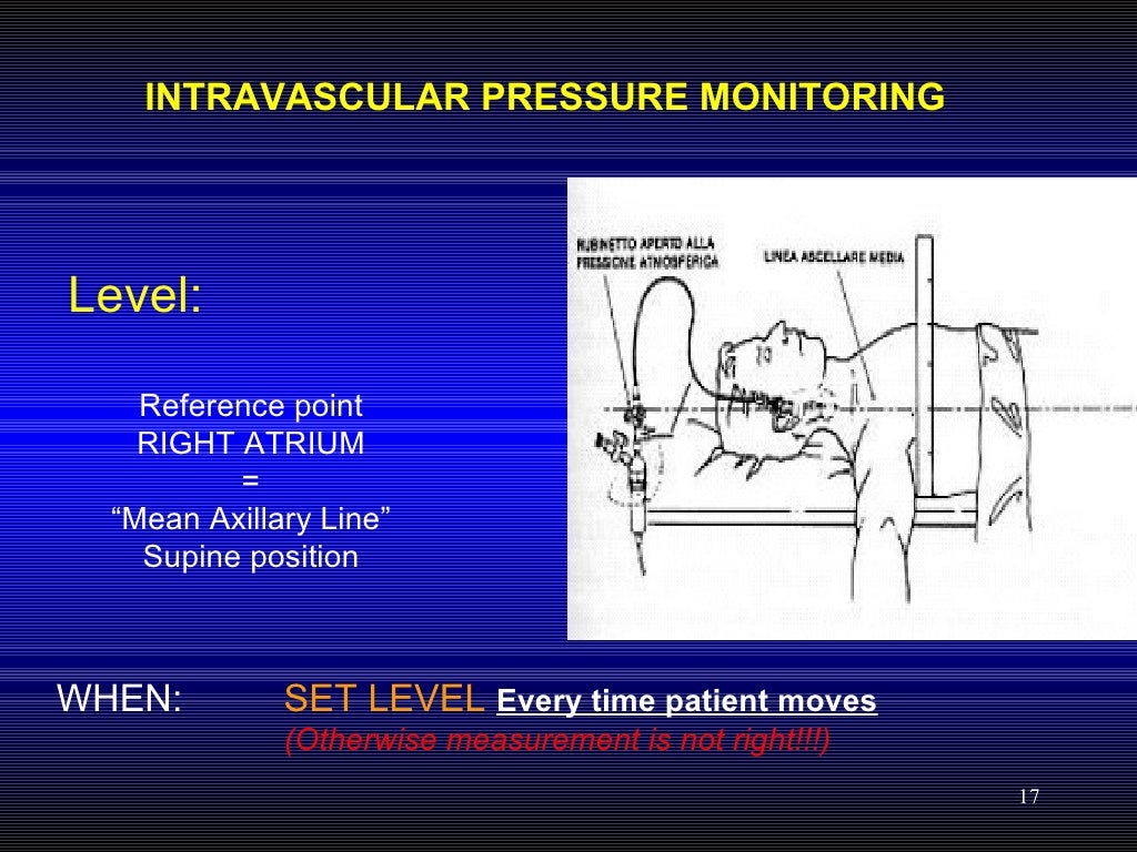 Hemodynamic Pressure Monitoring
