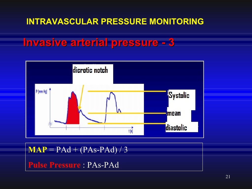 Hemodynamic Pressure Monitoring