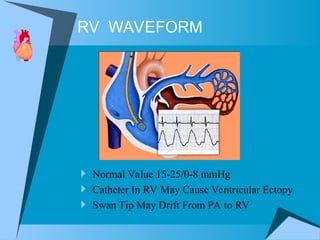 HEMODYNAMICS objectives, indication, contraindication | PPT