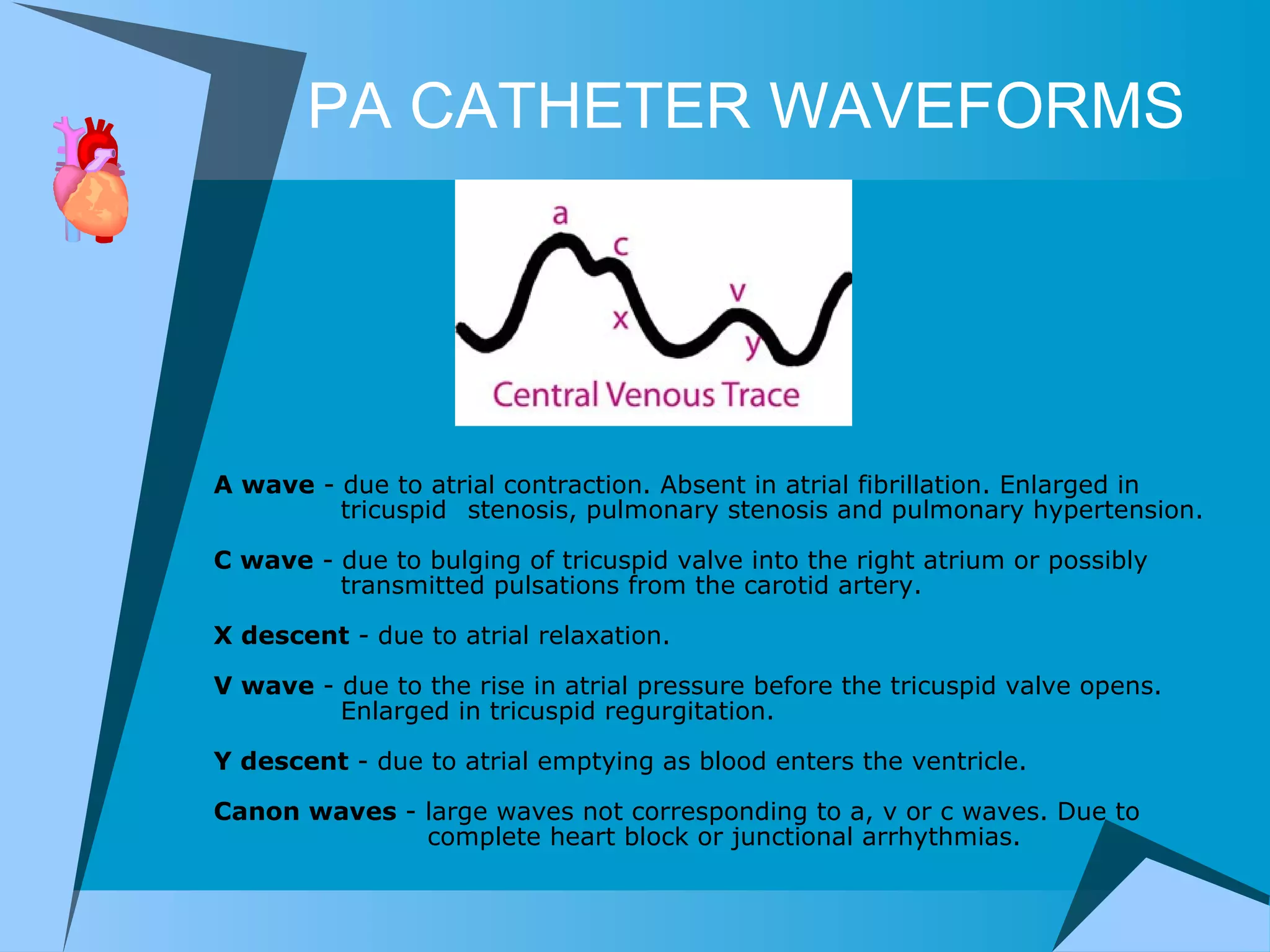 PA CATHETER WAVEFORMS A wave  - due to atrial contraction. Absent in atrial fibrillation. Enlarged in  tricuspid  stenosis, pulmonary stenosis and pulmonary hypertension. C wave  - due to bulging of tricuspid valve into the right atrium or possibly  transmitted pulsations from the carotid artery. X descent  - due to atrial relaxation. V wave  - due to the rise in atrial pressure before the tricuspid valve opens.  Enlarged in tricuspid regurgitation. Y descent  - due to atrial emptying as blood enters the ventricle. Canon waves  - large waves not corresponding to a, v or c waves. Due to    complete heart block or junctional arrhythmias. 