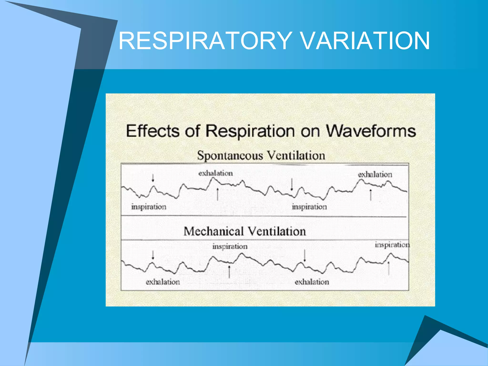 RESPIRATORY VARIATION 