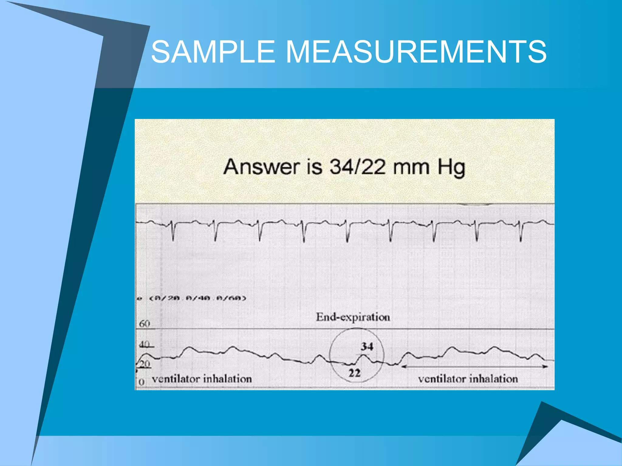 SAMPLE MEASUREMENTS 