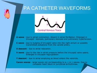 PA CATHETER WAVEFORMS A wave  - due to atrial contraction. Absent in atrial fibrillation. Enlarged in  tricuspid  stenosis, pulmonary stenosis and pulmonary hypertension. C wave  - due to bulging of tricuspid valve into the right atrium or possibly  transmitted pulsations from the carotid artery. X descent  - due to atrial relaxation. V wave  - due to the rise in atrial pressure before the tricuspid valve opens.  Enlarged in tricuspid regurgitation. Y descent  - due to atrial emptying as blood enters the ventricle. Canon waves  - large waves not corresponding to a, v or c waves. Due to    complete heart block or junctional arrhythmias. 