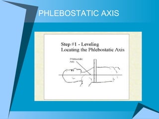PHLEBOSTATIC AXIS 