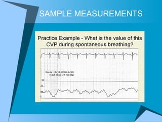 SAMPLE MEASUREMENTS 