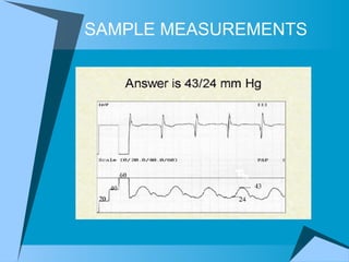 SAMPLE MEASUREMENTS 