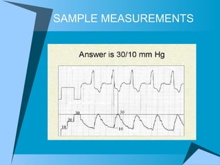 SAMPLE MEASUREMENTS 