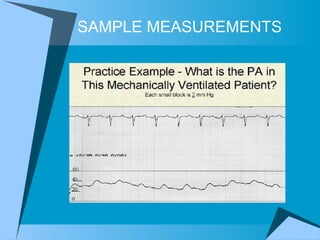 SAMPLE MEASUREMENTS 