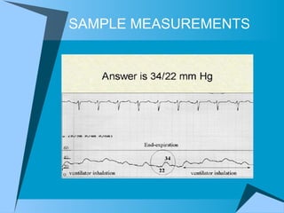 SAMPLE MEASUREMENTS 