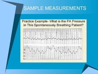 SAMPLE MEASUREMENTS 