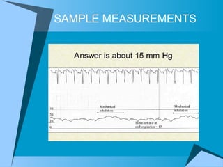 SAMPLE MEASUREMENTS 