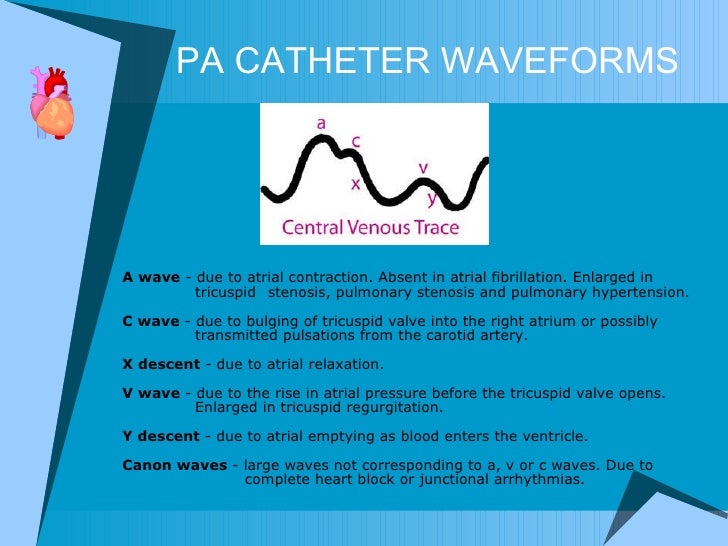 waves complete v waves complete v