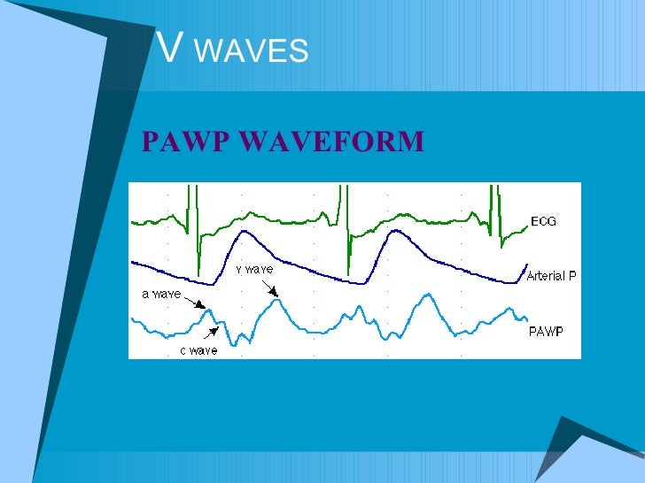 Hemodynamics