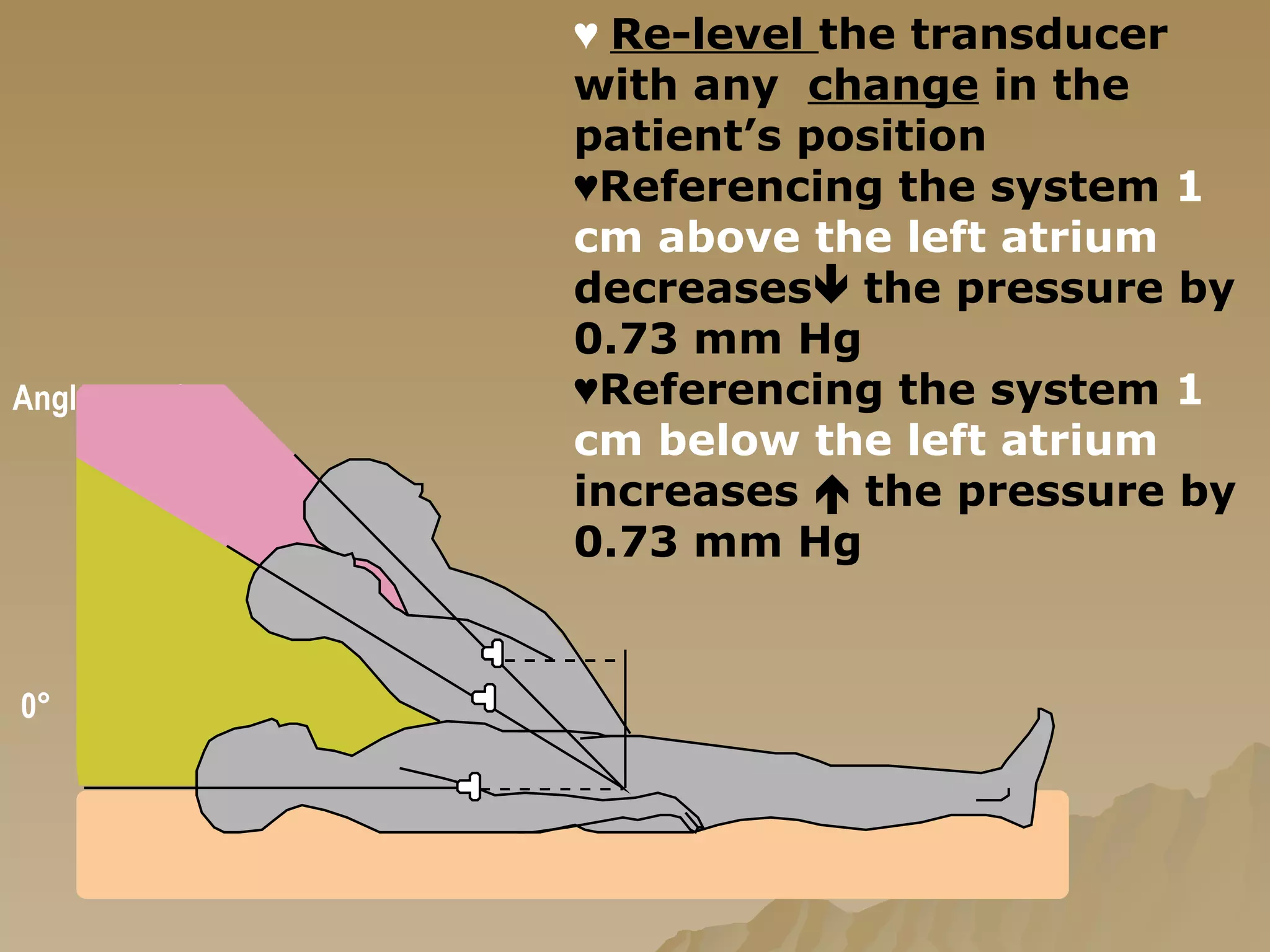 ♥  Re-level  the transducer with any  change  in the patient’s position ♥ Referencing the system  1 cm above the left atrium  decreases   the pressure by 0.73 mm Hg ♥ Referencing the system  1 cm below the left atrium  increases    the pressure by 0.73 mm Hg Angles  45°  30° 0 ° 