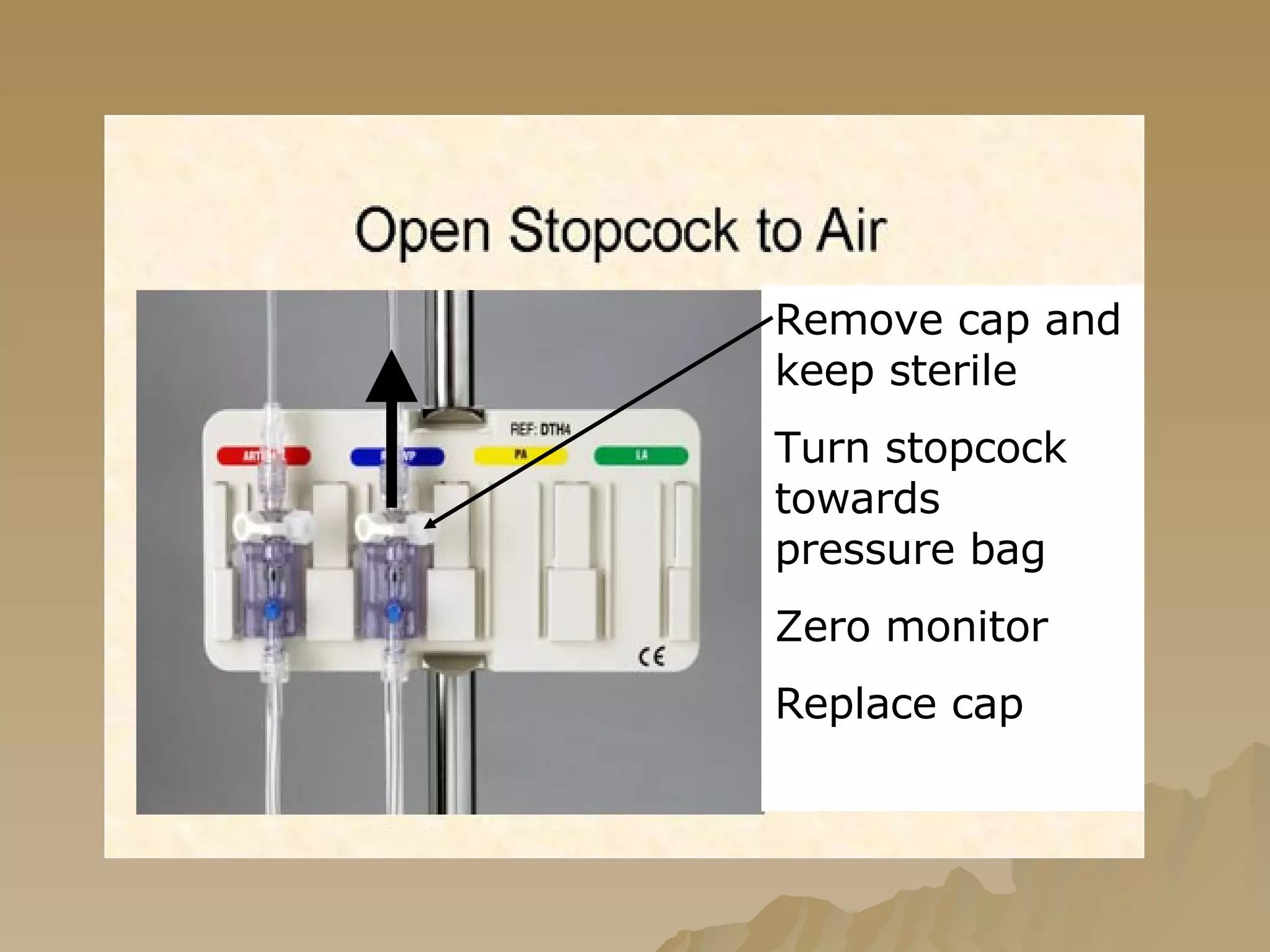 Remove cap and keep sterile Turn stopcock towards pressure bag Zero monitor Replace cap 