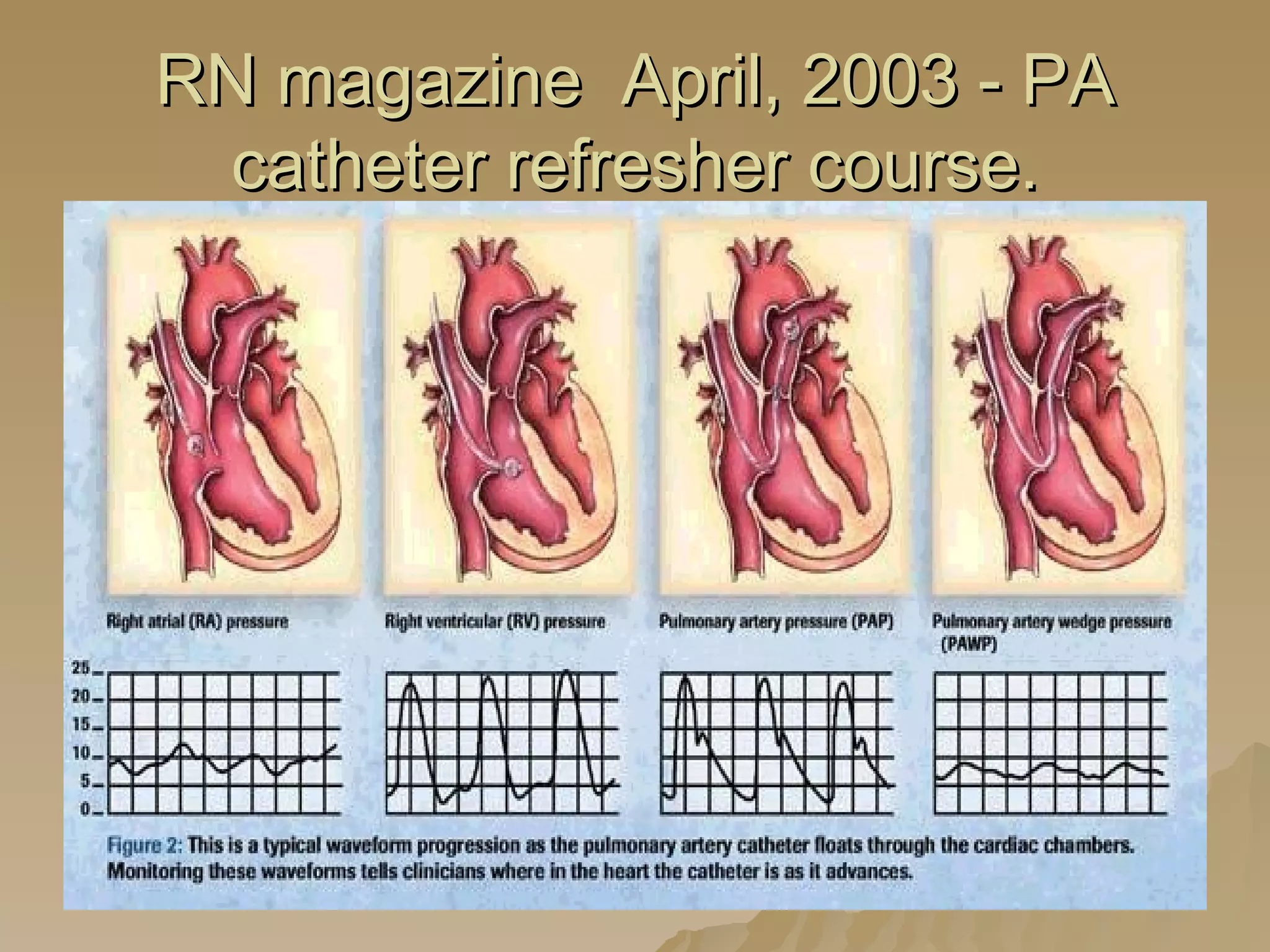 RN magazine  April, 2003 - PA catheter refresher course. 