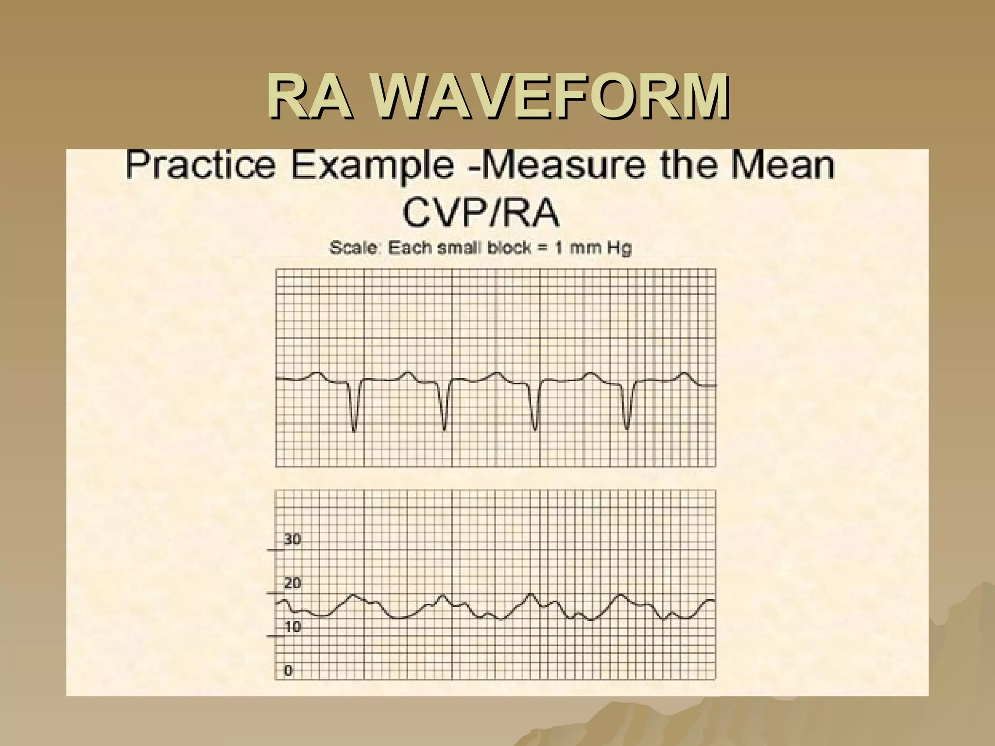 RA WAVEFORM 