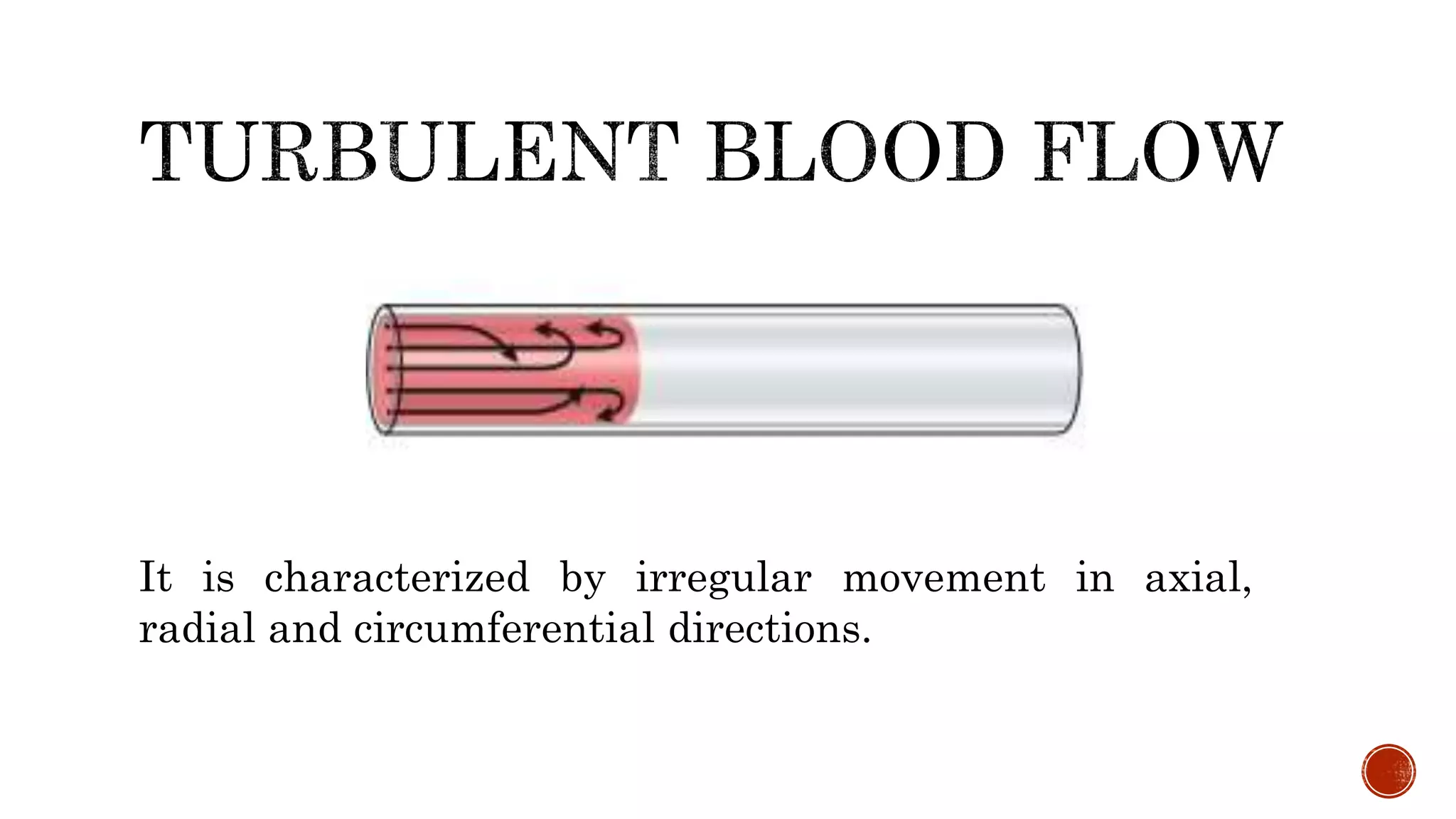 It is characterized by irregular movement in axial,
radial and circumferential directions.
 