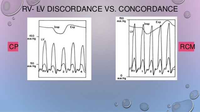 hemodynamics for dummies