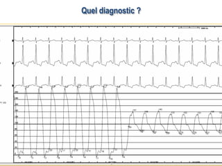 Quel diagnostic ?
 