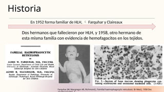 Historia
Dos hermanos que fallecieron por HLH, y 1958, otro hermano de
esta misma familia con evidencia de hemofagocitos en los tejidos.
En 1952 forma familiar de HLH,  Farquhar y Claireaux
Farquhar JW, Macgregor AR, Richmond J. Familial haemophagocytic reticulosis. Br Med J. 1958 Dec
 