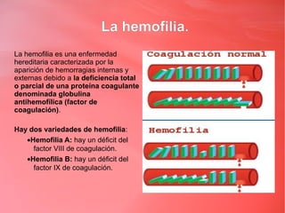 La hemofilia.
La hemofilia es una enfermedad
hereditaria caracterizada por la
aparición de hemorragias internas y
externas debido a la deficiencia total
o parcial de una proteína coagulante
denominada globulina
antihemofílica (factor de
coagulación).

Hay dos variedades de hemofilia:
   •Hemofilia A: hay un déficit del
     factor VIII de coagulación.
   •Hemofilia B: hay un déficit del
     factor IX de coagulación.
 