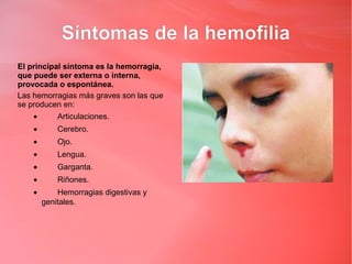 Síntomas de la hemofilia
El principal síntoma es la hemorragia,
que puede ser externa o interna,
provocada o espontánea.
Las hemorragias más graves son las que
se producen en:
    •       Articulaciones.
    •       Cerebro.
    •       Ojo.
    •       Lengua.
    •       Garganta.
    •       Riñones.
    •       Hemorragias digestivas y
        genitales.
 