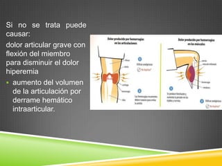 Si no se trata puede
causar:
dolor articular grave con
flexión del miembro
para disminuir el dolor
hiperemia
 aumento del volumen
de la articulación por
derrame hemático
intraarticular.
 