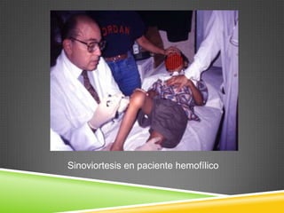 Sinoviortesis en paciente hemofílico
 