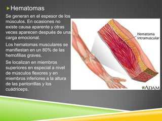 Hematomas
Se generan en el espesor de los
músculos. En ocasiones no
existe causa aparente y otras
veces aparecen después de una
carga emocional.
Los hematomas musculares se
manifiestan en un 80% de las
hemofilias graves.
Se localizan en miembros
superiores en especial a nivel
de músculos flexores y en
miembros inferiores a la altura
de las pantorrillas y los
cuádriceps.
 