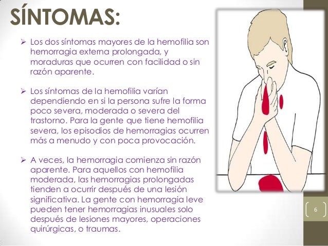 Hemofilia Hemofilia