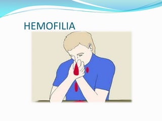 HEMOFILIA

 