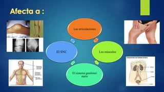 Las articulaciones

El SNC

Los músculos

El sistema genitouri
nario

 