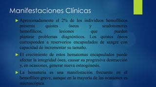 Manifestaciones Clínicas


Aproximadamente el 2% de los individuos hemofílicos
presenta
quistes
óseos
y
seudotumores
hemofílicos,
lesiones
que
pueden
plantear problemas diagnósticos. Los quistes óseos
corresponden a reservorios encapsulados de sangre con
capacidad de incrementar su tamaño.



El crecimiento de estos hematomas encapsulados puede
afectar la integridad ósea, causar su progresiva destrucción
y, en ocasiones, generar nueva osteogénesis.



La hematuria es una manifestación frecuente en el
hemofílico grave, aunque en la mayoría de las ocasiones es
microscópica.

 