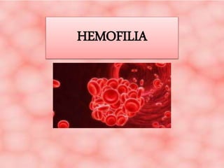 HEMOFILIA
 