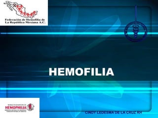 HEMOFILIA
CINDY LEDESMA DE LA CRUZ RH
 