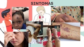 SINTOMAS
 