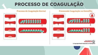 PROCESSO DE COAGULAÇÃO
 