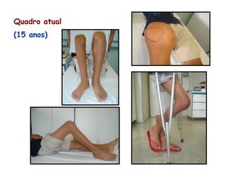 Quadro atual
(15 anos)
 