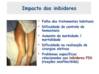 Impacto dos inibidores
• Falha dos tratamentos habituais
• Dificuldade do controle da
hemostasia
• Aumento da morbidade /
mortalidade
• Dificuldade na realização de
cirurgias eletivas
• Problemas específicos
relacionados aos inibidores FIX
(reações anafilactóide)
 