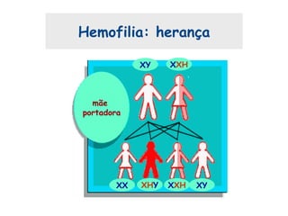 Hemofilia: herança
mãe
portadora
XY XXH
XX XXHXHY XY
 