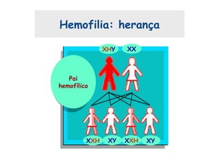 Hemofilia: herança
Pai
hemofílico
XHY XX
XXH XXHXY XY
 