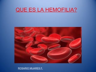 QUE ES LA HEMOFILIA?
ROSARIO MIJARES F.
 